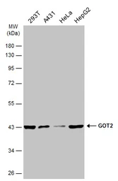 Anti-GOT2 antibody used in Western Blot (WB). GTX101930