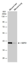 Anti-GOT2 antibody used in Western Blot (WB). GTX101930