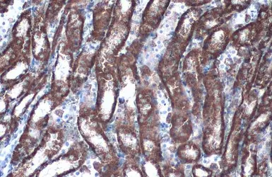 Anti-GOT2 antibody used in IHC (Paraffin sections) (IHC-P). GTX101930