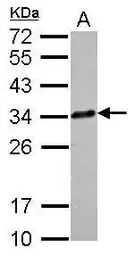 Anti-CLTA antibody [N1C3] used in Western Blot (WB). GTX101939