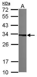 Anti-CKAP1 antibody [N1C3] used in Western Blot (WB). GTX101940
