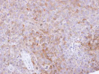 Anti-CKAP1 antibody [N1C3] used in IHC (Paraffin sections) (IHC-P). GTX101940