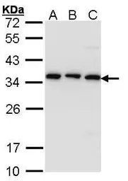 Anti-CKAP1 antibody [N1C3] used in Western Blot (WB). GTX101940