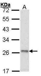Anti-ATP5O antibody [N1C3] used in Western Blot (WB). GTX101942