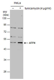 Anti-ATF4 antibody used in Western Blot (WB). GTX101944