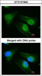 Anti-DNAJB6 antibody used in Immunocytochemistry/ Immunofluorescence (ICC/IF). GTX101946