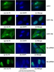 Anti-DNAJB6 antibody [N3C3] used in Immunocytochemistry/ Immunofluorescence (ICC/IF). GTX101947