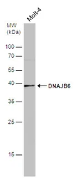 Anti-DNAJB6 antibody [N3C3] used in Western Blot (WB). GTX101947