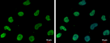 Anti-DNAJB6 antibody [N3C3] used in Immunocytochemistry/ Immunofluorescence (ICC/IF). GTX101947