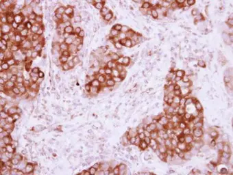 Anti-PHGDH antibody [N3C2], Internal used in IHC (Paraffin sections) (IHC-P). GTX101949