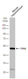 Anti-TPH2 antibody [N3C3] used in Western Blot (WB). GTX101962