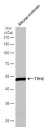 Anti-TPH2 antibody [N3C3] used in Western Blot (WB). GTX101962