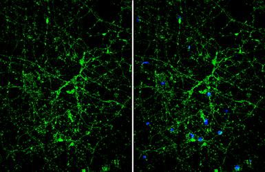 Anti-TPH2 antibody [N3C3] used in Immunocytochemistry/ Immunofluorescence (ICC/IF). GTX101962