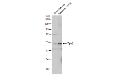 Anti-TPH2 antibody [N3C3] used in Western Blot (WB). GTX101962