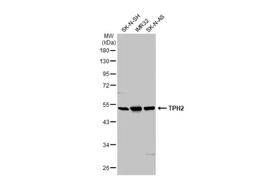 Anti-TPH2 antibody [N3C3] used in Western Blot (WB). GTX101962