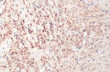 Anti-TPH2 antibody [N3C3] used in IHC (Paraffin sections) (IHC-P). GTX101962