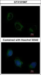 Anti-EIF3F antibody [N1C3] used in Immunocytochemistry/ Immunofluorescence (ICC/IF). GTX101967