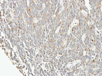 Anti-EIF3F antibody [N1C3] used in IHC (Paraffin sections) (IHC-P). GTX101967