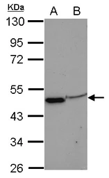 Anti-EIF3F antibody [N1C3] used in Western Blot (WB). GTX101967