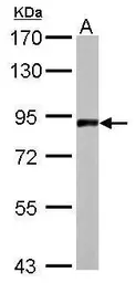 Anti-APLP2 antibody [N1N2], N-term used in Western Blot (WB). GTX101970