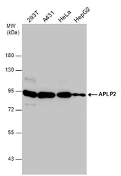 Anti-APLP2 antibody [N1N2], N-term used in Western Blot (WB). GTX101970