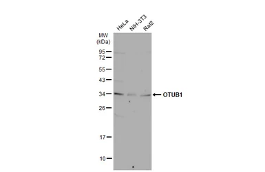 Anti-OTUB1 antibody [N1C1] used in Western Blot (WB). GTX101973