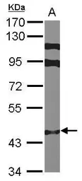 Anti-ZNF384 antibody [N1N2], N-term used in Western Blot (WB). GTX101975