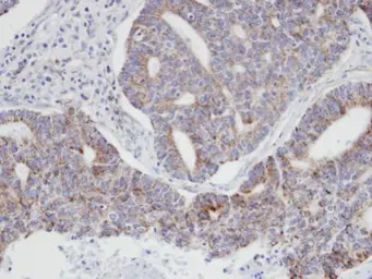 Anti-p21-ARC antibody [N1C3] used in IHC (Paraffin sections) (IHC-P). GTX101982