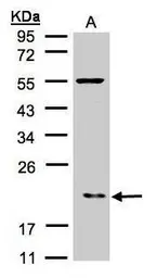 Anti-p21-ARC antibody [N1C3] used in Western Blot (WB). GTX101982
