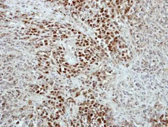 Anti-RAP1 antibody [N2C3] used in IHC (Paraffin sections) (IHC-P). GTX101983