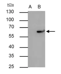 Anti-RAP1 antibody [N2C3] used in Immunoprecipitation (IP). GTX101983