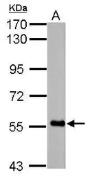 Anti-FBXO7 antibody used in Western Blot (WB). GTX101986