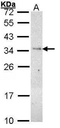 Anti-PLSCR3 antibody [N1C3] used in Western Blot (WB). GTX101987
