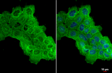 Anti-HAX1 antibody used in Immunocytochemistry/ Immunofluorescence (ICC/IF). GTX101992