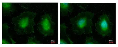 Anti-EIF3K antibody used in Immunocytochemistry/ Immunofluorescence (ICC/IF). GTX101995