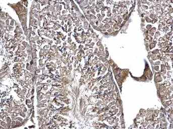 Anti-EIF3K antibody used in IHC (Paraffin sections) (IHC-P). GTX101995