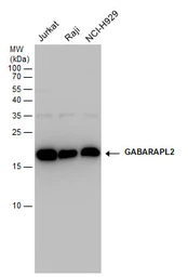 Anti-GABARAPL2 antibody used in Western Blot (WB). GTX102006
