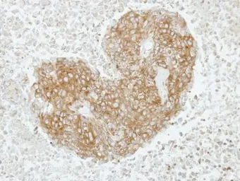 Anti-GABARAPL2 antibody used in IHC (Paraffin sections) (IHC-P). GTX102006