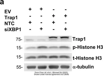 Anti-TRAP1 antibody used in Western Blot (WB). GTX102017
