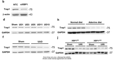 Anti-TRAP1 antibody used in Western Blot (WB). GTX102017