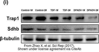 Anti-TRAP1 antibody used in Western Blot (WB). GTX102017