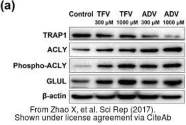 Anti-TRAP1 antibody used in Western Blot (WB). GTX102017