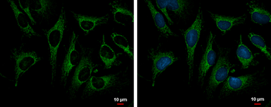 Anti-TRAP1 antibody used in Immunocytochemistry/ Immunofluorescence (ICC/IF). GTX102017