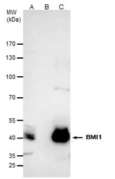 Anti-Bmi1 antibody used in Immunoprecipitation (IP). GTX102020