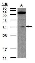 Anti-Malectin antibody used in Western Blot (WB). GTX102021