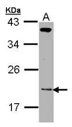 Anti-ZNHIT1 antibody [N1C3] used in Western Blot (WB). GTX102030