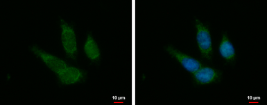 Anti-PTOV1 antibody used in Immunocytochemistry/ Immunofluorescence (ICC/IF). GTX102033