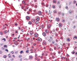 Anti-RUVBL2 antibody [C1C3] used in IHC (Paraffin sections) (IHC-P). GTX102037