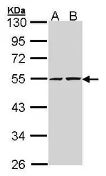 Anti-RUVBL2 antibody [C1C3] used in Western Blot (WB). GTX102037