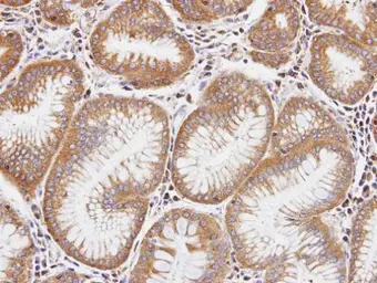 Anti-DIAPH1 antibody [N1N2], N-term used in IHC (Paraffin sections) (IHC-P). GTX102042